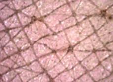 Δέρμα μετά την εφαρμογή των μικροσωματιδίων ρύπων Δέρμα που έχει καθαριστεί με νερό Δέρμα που έχει καθαριστεί με συμβατικό καθαριστικό Δέρμα που έχει καθαριστεί με OlioGel Algadetox Το OlioGel