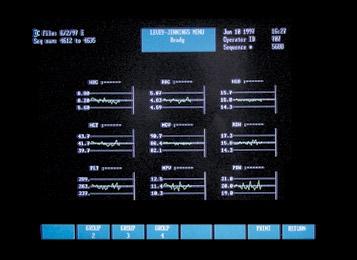 This system generates a specific flag correlating to the types of cells found in chronic lymphocytic leukemia and other lymphoid malignancies.