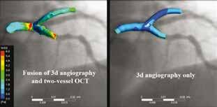 10th CONGRESS OF INNOVATIONS IN INTERVENTIONAL CARDIOLOGY & ELECTROPHYSIOLOGY ΠΕΡΙΛΗΨΕΙΣ ΕΡΓΑΣΙΩΝ ΕΠΕΜΒΑΤΙΚΗΣ ΚΑΡΔΙΟΛΟΓΙΑΣ Αποτελέσματα: Και τα τρία στελέχη μπόρεσαν να ανακατασκευαστούν και με τους
