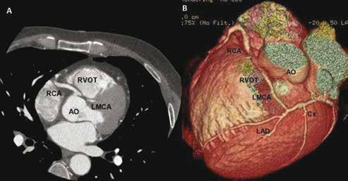 10th CONGRESS OF INNOVATIONS IN INTERVENTIONAL CARDIOLOGY &