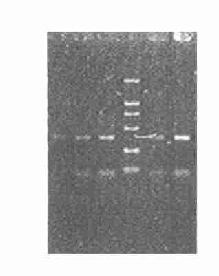 6 : cdna 695 Fig 2 PCR amplification of 2subunit gene 1,2,3,5,6 :Products