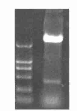 Double enzyme digestion of recombinant plasmid 1 :DL2000 marker 2