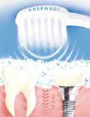 Καταστρέφει μικρόβια και βακτήρια έως 12mm κάτω από τη γραμμή των ούλων όπου καμία οδοντόβουρτσα ή νήμα δεν μπορεί να φτάσει.