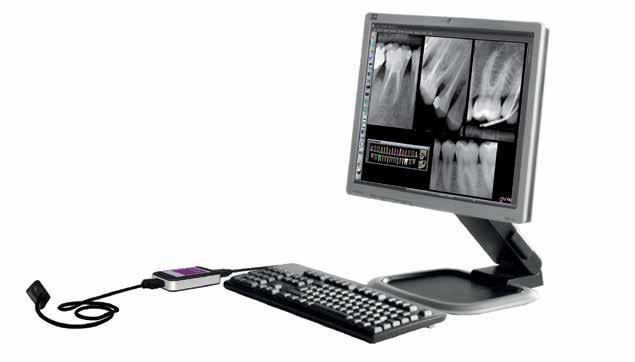 Anthos A3 Premium edition & Ψηφιακή ακτινογραφία MyRay ZEN-X Στην καλύτερη τιμή που έγινε ΠΟΤΕ!