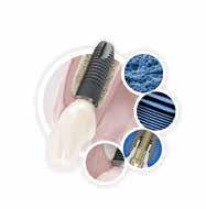 Πρακτικά Θέματα 8 Dental Tribune Greek Edition DT σελίδα 7 ένα μεγάλο περιστατικό.