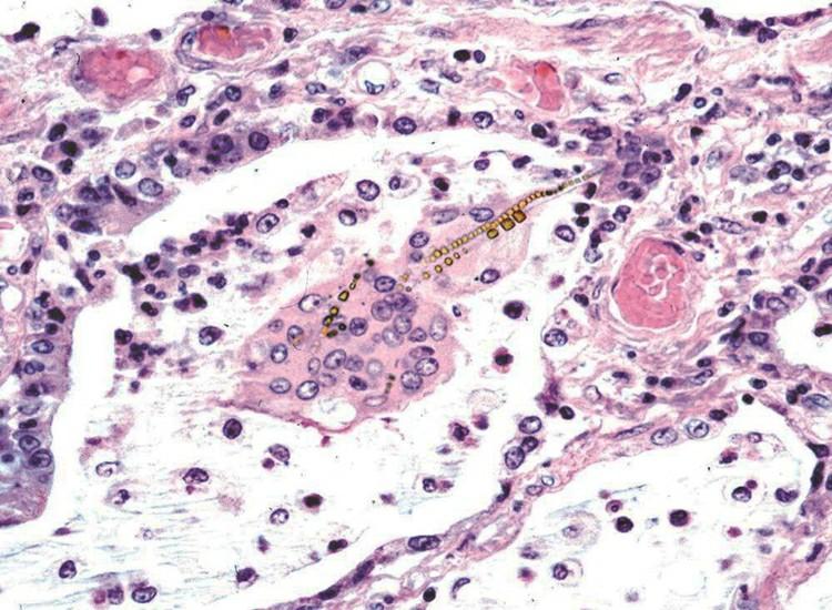 the peritoneal face of the diaphragm of a mouse showing the stomata (arrows) reproduced with