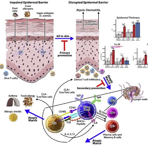 Allergy Clin Immunol, 2014