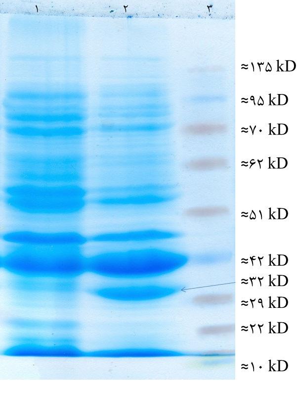 LFD1 : TA cloning 1994. ) T ( MCS -β.