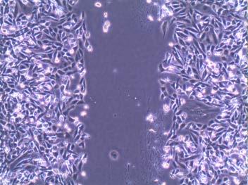 sunitinib.