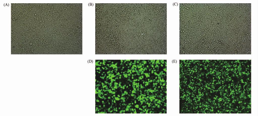 8 ω-3 fat-1 759 Fig 3 Fluorescence photos of mouse embryonic fibroblasts after transfection 48 hours 200 After transfection 48 hours the expressed protein level was detected by Laser Scanning