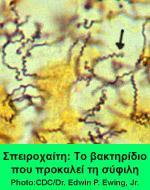 ΣΥΦΙΛΗ Προκαλείται από το Treponema pallidum (τρεπόνημα το ωχρό), μια σπειροχαίτη που δεν καλλιεργείται (κυτταροκαλλιέργεια) Μεταδίδεται με άμεση επαφή διεισδύοντας δια μέσου του υγιούς βλεννογόνου