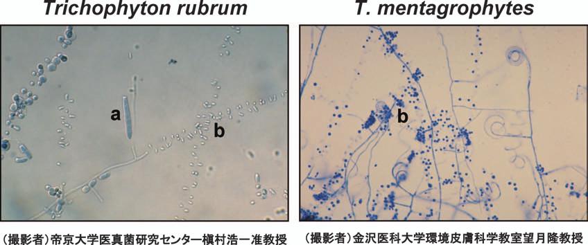 3 1. Microsporum fulvum M. canis Epidermophyton floccosum M. gypseum M. gallinae T. concentricum M. nanum T. equinum T. mentagrophytes Trichophyton ajelloi T. mentagrophytes var. interdigitale T.