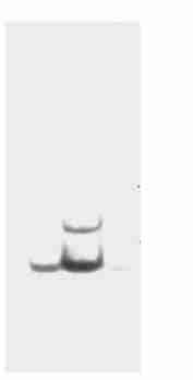 2 N o rthern blo t analysis C: C irrho sis tissue; H: H epatocellular carcinom a tissue 214 cdna pgem 2T easy, 20 520 bp, F ig. 3 F ig.