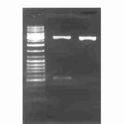 lecular w eight DNA m arker The differential cdna band of N o.