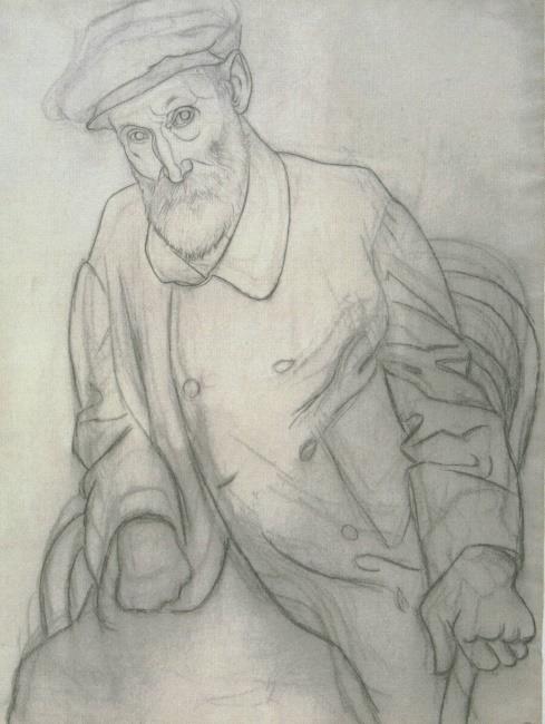 Η ζεξαπεπηηθή ηεο ξεπκαηνεηδνύο αξζξίηηδαο ζηνλ 20 ν αηώλα Picasso: Renoir 1898 αζπηξίλε 1948 θνξηηδόλε 1956 παξαθεηακόιε 1960 θαηλπινβνπηαδόλε SAARDs: