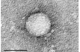 Ηπατίτιδα C (HCV) RNA ιός