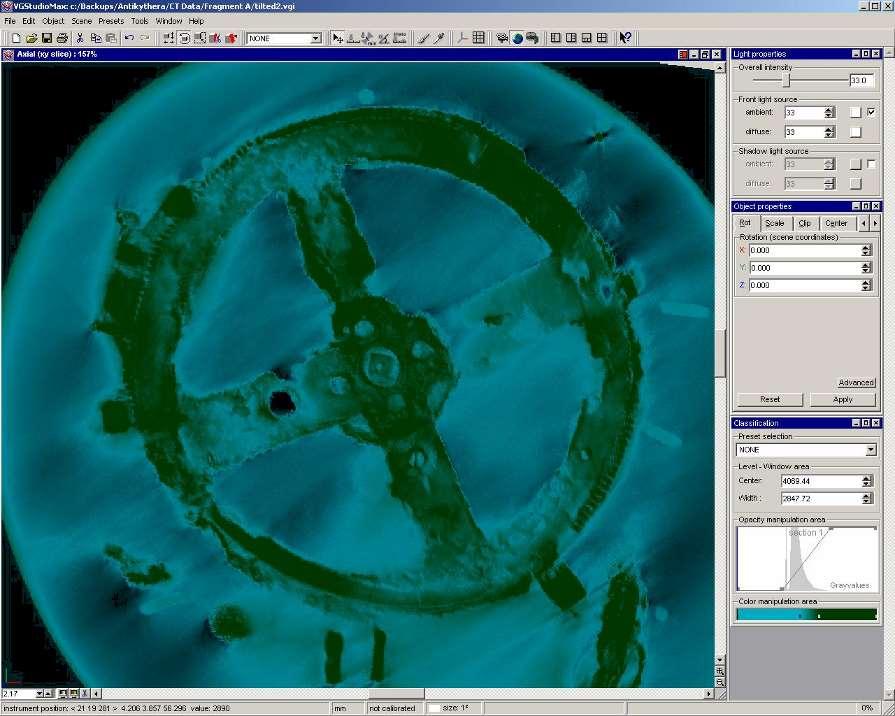 We have studied the structure using computer tomographi es