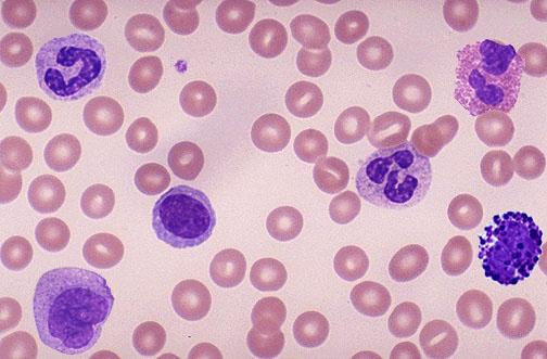 μηχανισμός δράσης imatinib