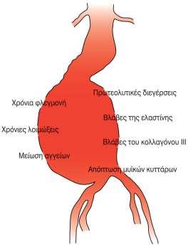 Αίτια δημιουργίας δεν έχει με ακρίβεια διαλευκανθεί πολύ παράγοντες συμβάλλουν στην εξέλιξή τους > 90% των ασθενών εμφανίζει ταυτόχρονα αθηρωμάτωση γενετικά προκαθορισμένες βλάβες της ελαστίνης και