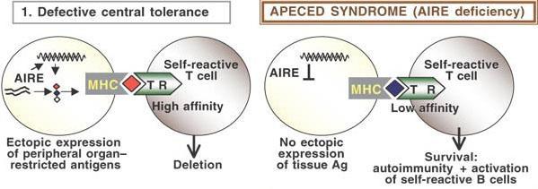 η έκφραση AIRE στο θύμο συνδέεται με τη διαφοροποίηση των θυμοκυττάρων (απαιτεί τη συνεργασία μεταξύ των θυμοκυττάρων και των