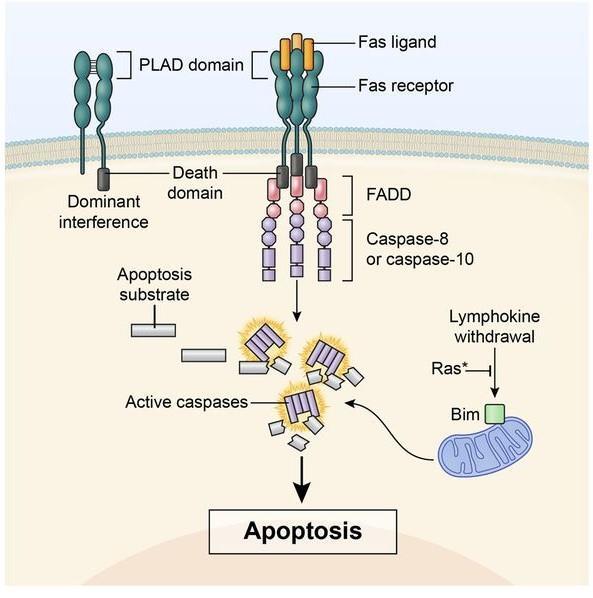 Αυτοάνοσο Λεμφοϋπερπλαστικό Σύνδρομο (ALPS) Διαταραχή της απόπτωσης και του προγραμματισμένου κυτταρικού θανάτου των λεμφοκυττάρων παραμονή αυτοδραστικών κυττάρων αυτοανοσία-κακοήθεια