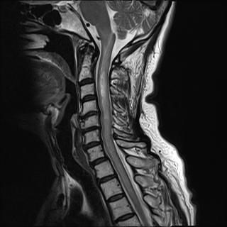 MRI ΑΜΣΣ