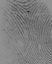 [9], Asker MBazen [0] [],, Poincare index [3] delta core,,,, ;,,, (Poincare index