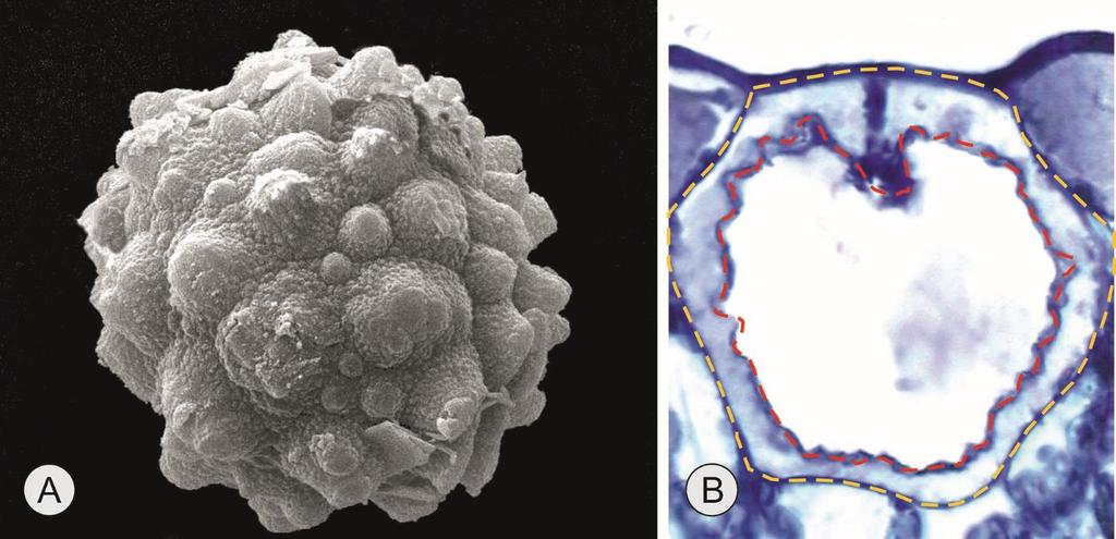 Οι κυστόλιθοι αποτελούν συσσωρεύσεις κυρίως ανθρακικού ασβεστίου σε εξειδικευμένα κύτταρα Α. (Η.Μ.Σ.) Απομονωμένος κυστόλιθος από ιδιόβλαστο κύτταρο (λιθοκύστη) του φυτού Parietaria judaica. Β.