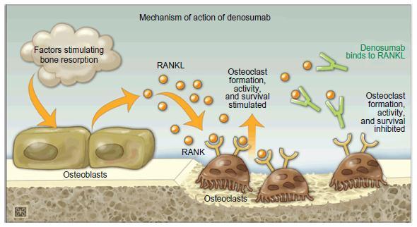 DENOSUMAB Μονοκλωνικό αντίσωμα Πρόσδεση σε RANK-L -> εμποδίζει την πρόσδεση του RANK-L