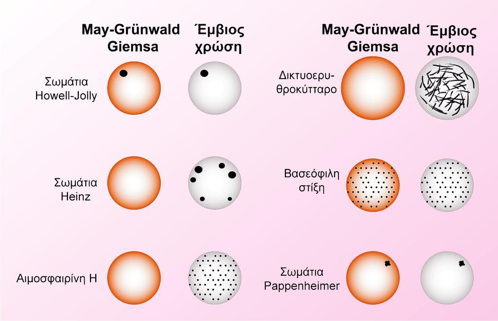 ΕΡΥΘΡΟΚΥΤΤΑΡΑ 131 Σχήμα 36. Σύγκριση συγκεκριμένων ερυθροκυτταρικών εγκλείστων σε έμ βια χρώση και σε χρώση May-Grünwald- Giemsa.