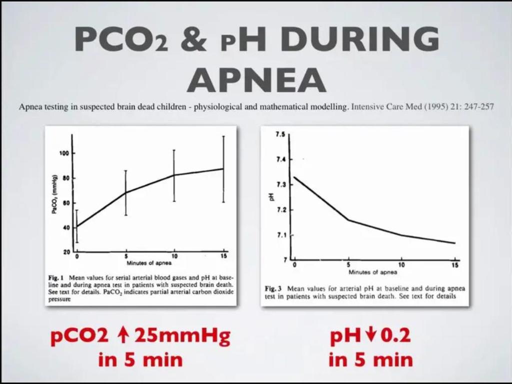 Απνοϊκή Οξυγόνωση (Apneic oxygenation)