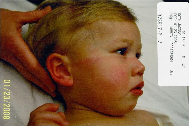 Αξονική Τομογραφία Αγοράκι 2 ετών, με πόνο στον αυχένα μετά από πέσιμο, προσέρχεται για αξονική.