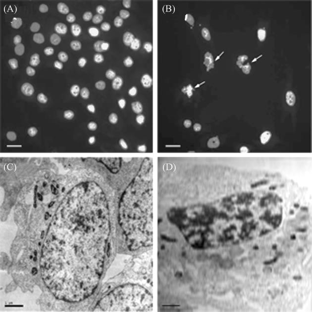 6 MG-63 549 2 3 MG-63 3 Bio- Fig 1D Fig 1 The effect of curcumin treatment on the morphology and ultrastructure of MG-63 cells Untreated MG-63 cells A and cells treated with curcumin B were observed
