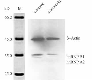 6 MG-63 551 Fig 3 Confirmation of the differential expression of hnrnp A2 / B1 from NMPs samples by Western boltting β-actin was used as a protein loading control The bands were detected by an