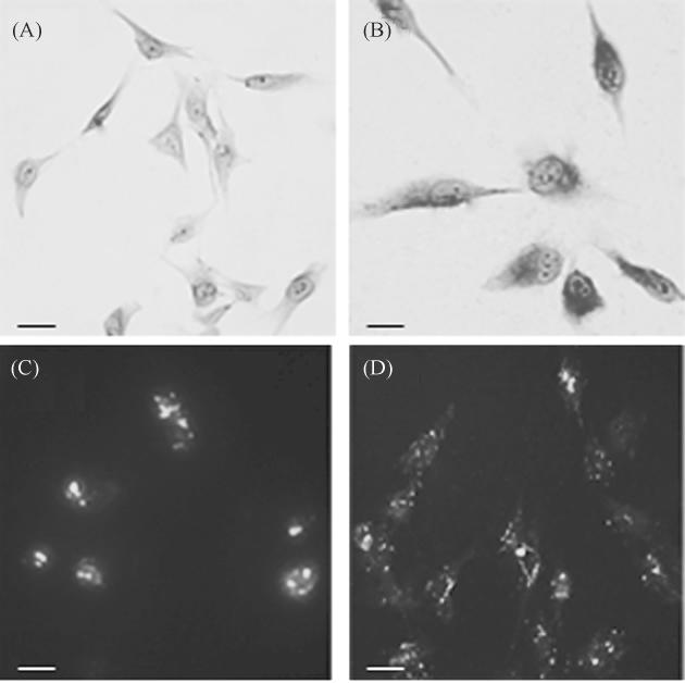 or fluorescent microscope observation of the nuclear matrixintermediate filament system of MG-63 cells Observation of NM-IF system in MG-63 cells A and treated cells B by light microscopy dyed by CBB