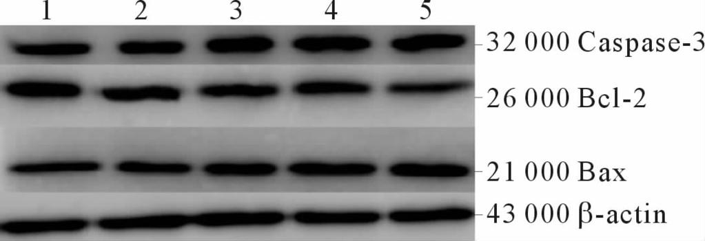 JournalofZhengzhouUniversity(MedicalSciences) Sept. 2017 Vol.52 No.5 561 2.4 TCDD! "# 2S < 2, TCDD F H 9, YX Bax Caspase 3 UVcB<=., Bcl 2U V c B < =. 1~5:0 1 5 10 50nmol/LTCDDb 2 5=!