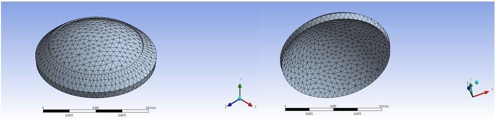 4.4 ΜΟΝΤΕΛΟ ΜΕ ΚΡΗΜΝΟ ΑΠΟ FEMTOSECOND LASER Θεωρούμε την πλάγια επιφάνεια του μοντέλου, δηλαδή το όριο που ο κερατοειδής συνδέεται με το σκληρό χιτώνα, αμετακίνητη ως οριακή συνθήκη. Σχήμα 4.