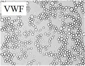 Ο παράγοντας von Willebrand λειτουργεί ως μια επιφάνεια προσκόλλησης των λευκοκυττάρων In vitro μελέτη Ο VWF προσφέρει θέσεις σύνδεσης με υποδοχείς των λευκοκυττάρων που εμπλέκονται στην κύλιση