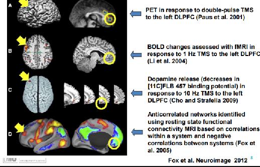 Functional connectivity between the left DLPFC and ventral