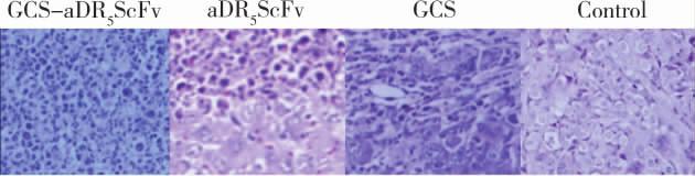 05) GCS GCS-aDR 5 ScFv adr 5 ScFv activecaspase8 active-caspase3 BAX GCS GCS-aDR 5 ScFv Fig 2 The shape of the GCS and GCS-aDR 5 ScFv detected by SEM 1 Tab 1 Characteristics of the GCS nanoparticles