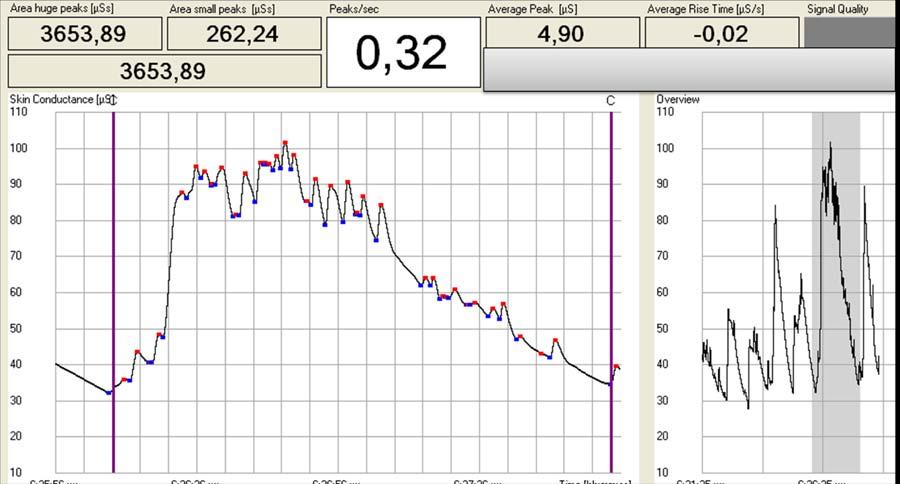 Σχήμα 3.13.5. Υπολογισμός της «περιοχής μικρών κορυφών». Στο ακόλουθο σχήμα φαίνεται παράδειγμα αυτών των καταγραφών Σχήμα 3.13.6.