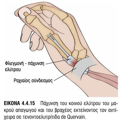 Συνεδρία=17B1-17β6, 18Β4, 18Β5 5η -10η Συνεδρία= 17Α1,17Α3, 17Α6-17Α8 Πηχεοκαρπ