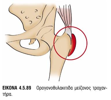 1η -3η/4η Συνεδρία=13Β7,13Β8, 13Β9, 8Β1-8Β8 (έμφαση στον χειρισμό 8Β7) Μηρός / Ισχίο 5η -8η