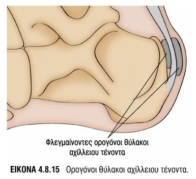 Ορογονοθυλακίτιδα αχίλλειου τένοντα 5η -8η Συνεδρία=4Α1-4Α9, (Έμφαση στον χερισμό 4Α5) 1η -3η/4η