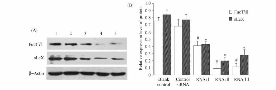3 RNA FucT Ⅶ HT-29 HUVECs 293 Fig 3 Western blot analysis for FucT Ⅶ and slex protein in transfecting HT-29 cells with sirna Cell lysates were prepared The proteins in lysates were separated by 10%