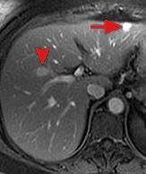 ειδικότητα της MRI