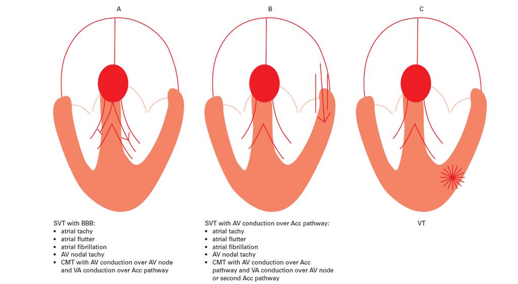 Classification of