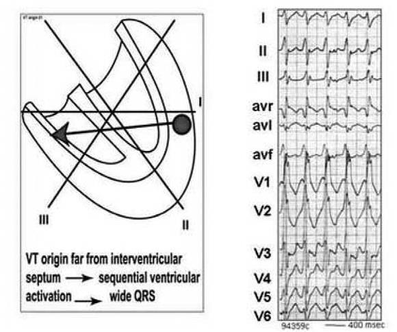 of ventricular