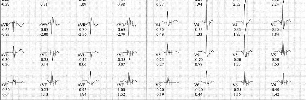Cardiac