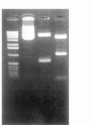 3 : T IM P21 cdna CO S27 309 A vag T IM P21 cdna, 4 880 bp 1 119 bp 99 bp 3 (F ig.